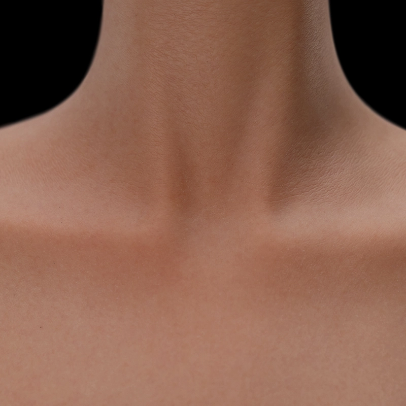 Skin#3