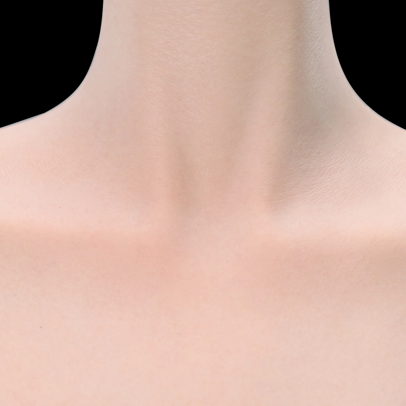 Skin#1